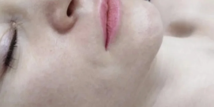Péče pro všechny typy pleti: chemický peeling, masáž, karboxyterapie i mikrojehličkování