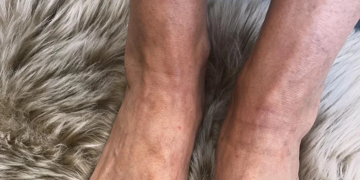 Přístrojová pedikúra: ošetření pokožky i nehtů s možností gel laku