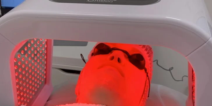 Kosmetické ošetření dle výběru: karbonový peeling, hydrodermabraze i kryomasáž obličeje
