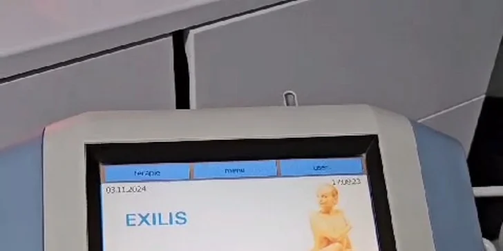 Vytvarovaná postava snů: neinvazivní liposukce partií těla přístrojem Exilis