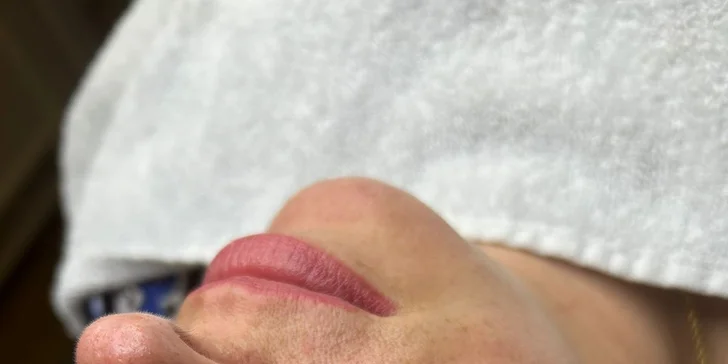 Kosmetická péče proti vráskám, akné i pigmentovým skvrnám: nanoneedling i biomicroneedling