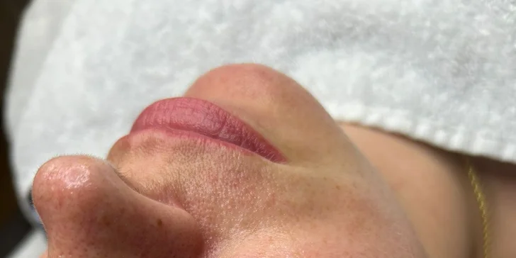 Kosmetická péče proti vráskám, akné i pigmentovým skvrnám: nanoneedling i biomicroneedling