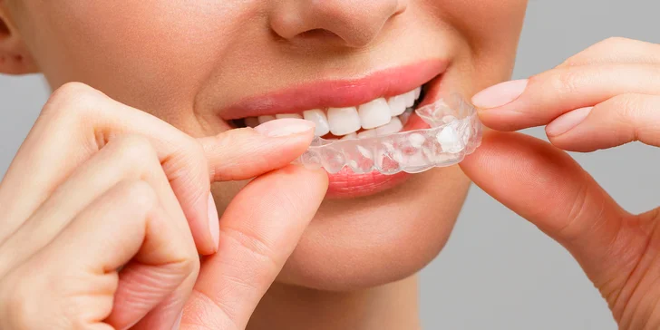 Dentální hygiena vč. pískování zubů nebo set na domácí bělení zubů