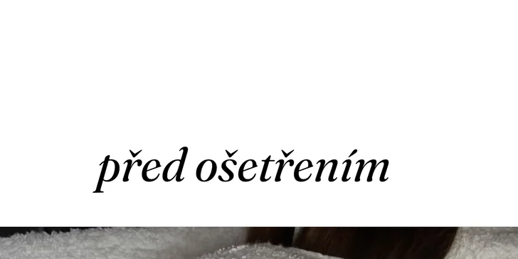 Kosmetické ošetření dle výběru: liftingové, hydratační i mikrojehličkování