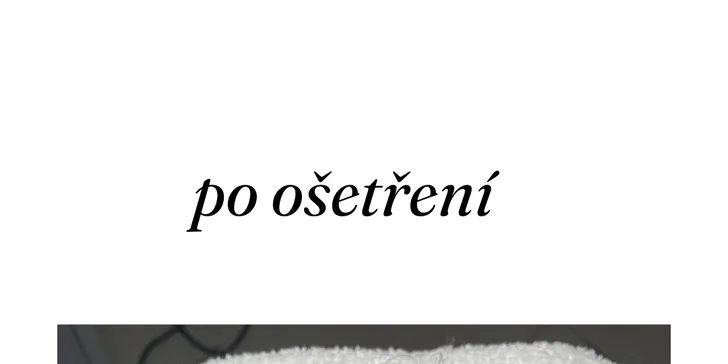 Kosmetické ošetření dle výběru: liftingové, hydratační i mikrojehličkování