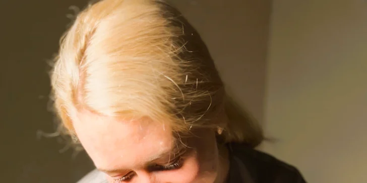 Laserová epilace obličeje a krku, podpaží, bikin i celých nohou