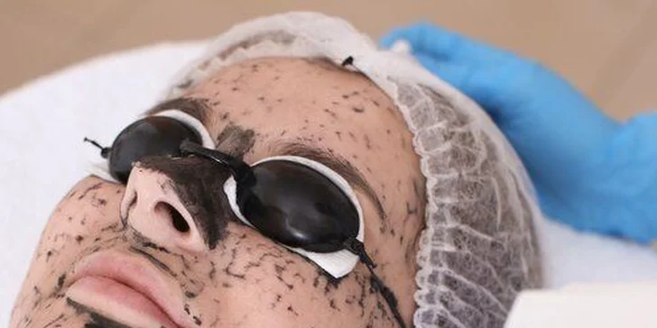 Karbonový peeling, hloubkové čištění i masáž obličeje pro omlazení pleti