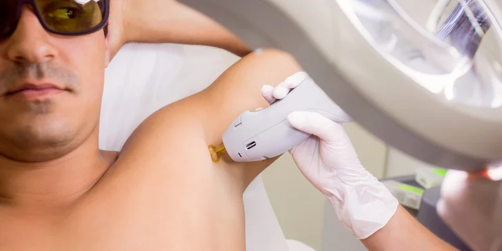 Sametově hebká pokožka bez chloupků: laserová epilace vybraných partií pro ženy i muže