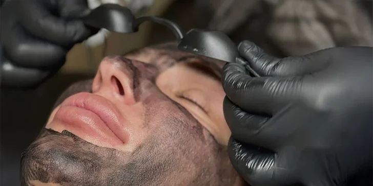Karbonový peeling, hloubkové čištění i masáž obličeje pro omlazení pleti