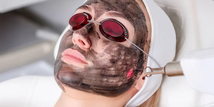 Peeling pro omlazení pleti: maska s aktivním uhlím a laserové ošetření