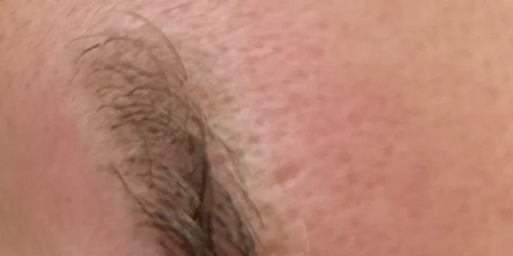 Permanentní make-up očí, rtů či obočí nebo odstranění tetování či permanentního make-upu