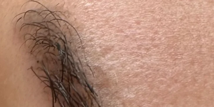 Permanentní make-up očí, rtů či obočí nebo odstranění tetování či permanentního make-upu