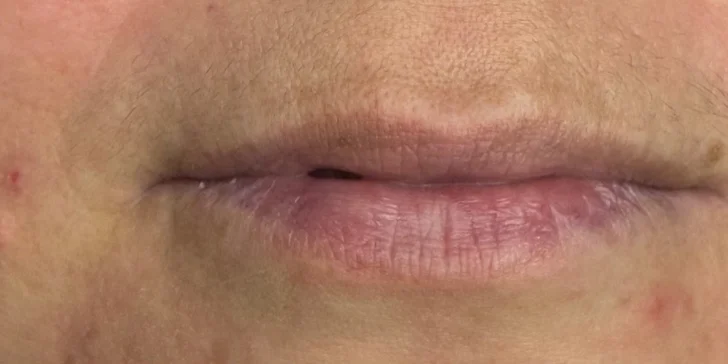 Permanentní make-up očí, rtů či obočí nebo odstranění tetování či permanentního make-upu