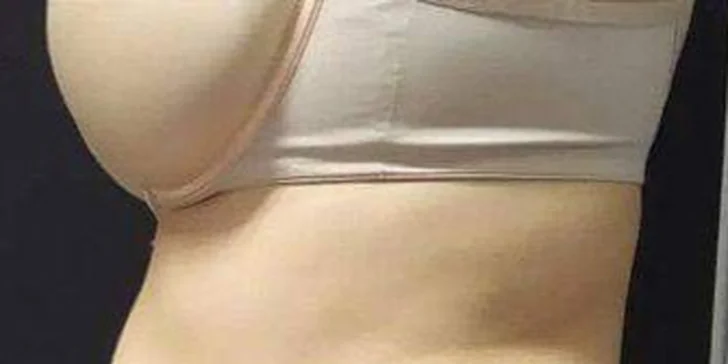 Cvičení na vibrační plošině nebo ošetření jedné partie pomocí Emslim