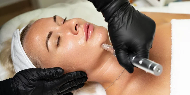 Mezoterapie obličeje, krku a dekoltu dermapenem i radiofrekvenční lifting