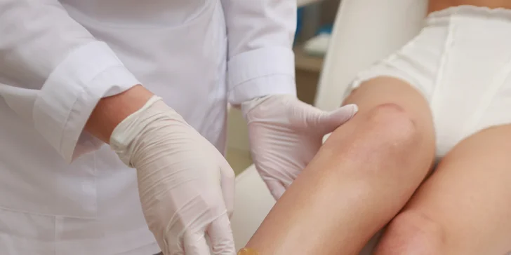 Až 10x depilace voskem celých nohou nebo oblasti bikin i brazislká
