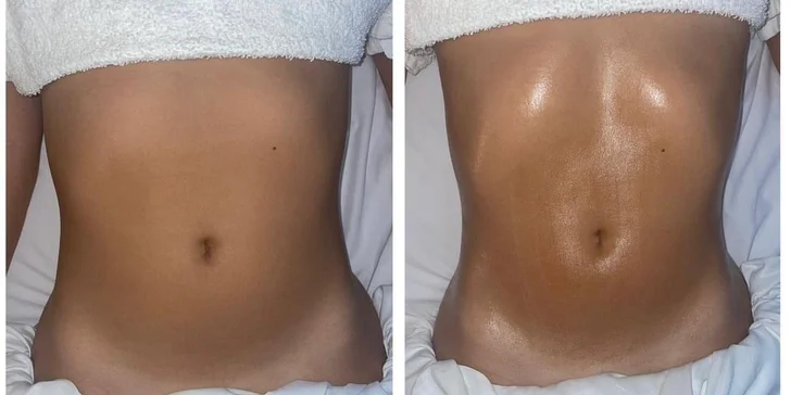 Hloubková péče o tělo: kolumbijská, brazilská maderoterapie i lymfomodelace