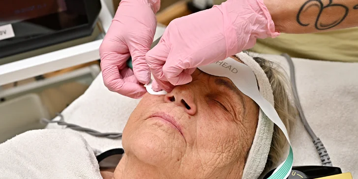 Omládněte o pár let: neinvazivní účinný lifting CPT Thermage nebo EMfacelift