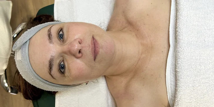Komplexní kosmetické ošetření nebo péče Golden skin s kaviárem a zlatem