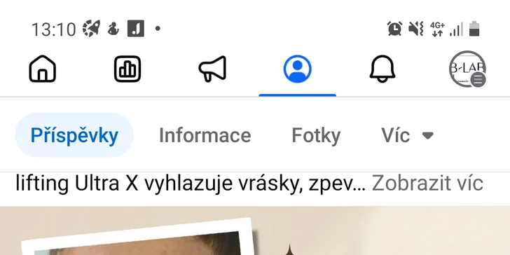 Pevnější pokožka s přístrojem nové generace: lifting obličeje a krku