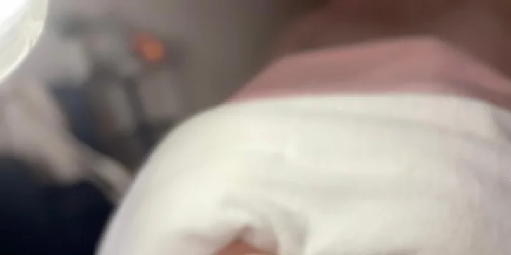 90 minut kosmetické péče s laserem, LED a kryoterapií pro omlazení pleti
