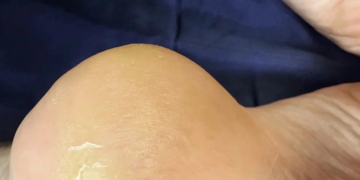 Relax a krásné nehty: manikúra s masáží rukou i mokrá pedikúra a peeling