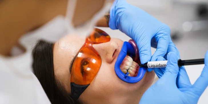 Ordinační bělení zubů LED lampou Philips Zoom s možností dentální hygieny