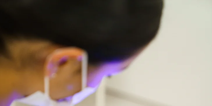 Ordinační bělení zubů LED lampou Philips Zoom s možností dentální hygieny