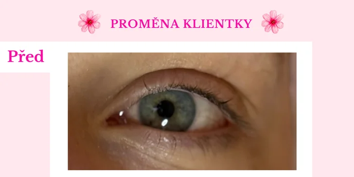 Ohromující pohled: laminace obočí, lash lifting či balíček obou procedur