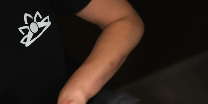Aromaterapeutické kosmetické ošetření s liftingovou maskou a masáží obličeje