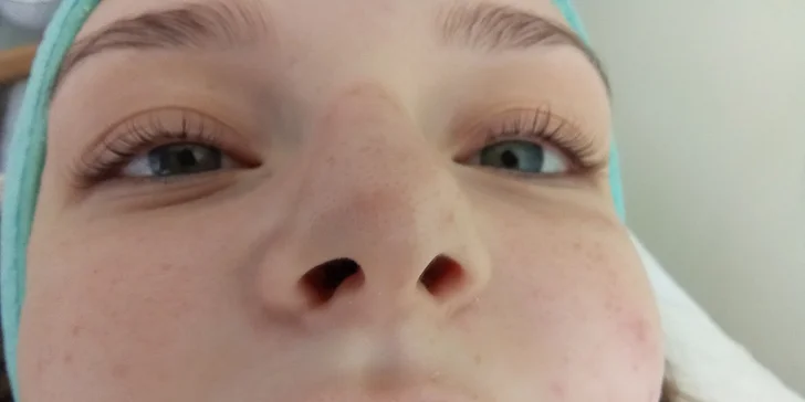 Laminace obočí, lash lifting nebo masáž obličeje a dekoltu