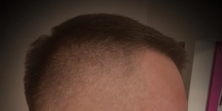 Kadeřnický balíček pro muže: masáž hlavy, klasický i skin fade střih a úprava vousů