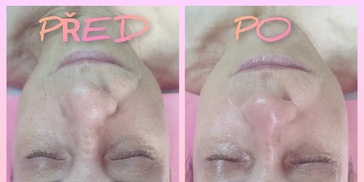Kosmetické ošetření: diagnostika, čištění, peeling i masáž, 30–⁠⁠⁠⁠⁠⁠90 minut