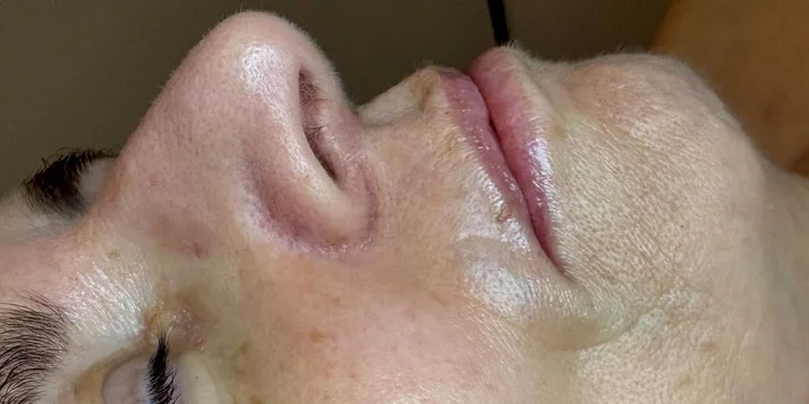 Kosmetické ošetření: diagnostika, čištění, peeling i masáž, 30–⁠⁠⁠⁠⁠⁠90 minut