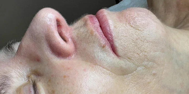 Kosmetické ošetření: diagnostika, čištění, peeling i masáž, 30–⁠⁠⁠⁠⁠⁠90 minut
