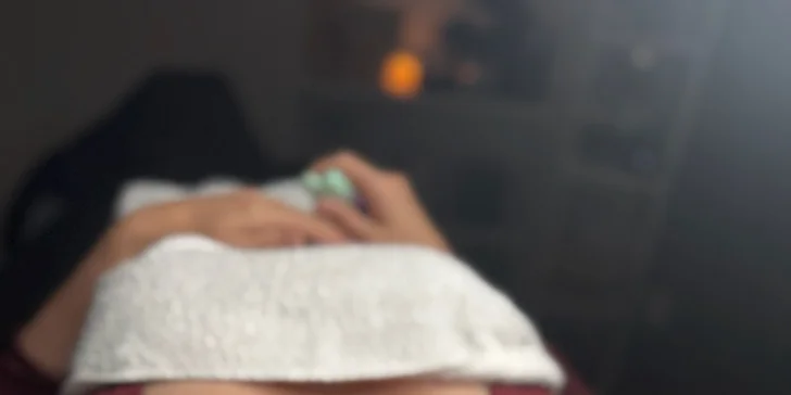 Cesta za omlazením pleti: chemický peeling pro redukci vrásek, 1 až 5 ošetření