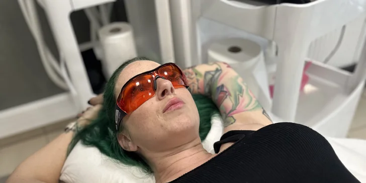 Dokonale hladká pokožka: laserová epilace pro ženy i muže, horní ret, brada, podpaží i nohy