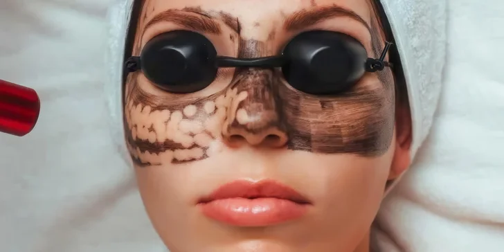 Rozmazlete svou pleť: karbonový peeling v délce 30 až 40 minut