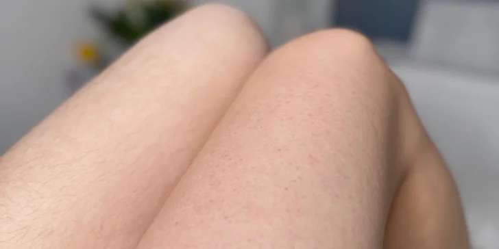 Depilace cukrovou pastou či voskem vybrané partie