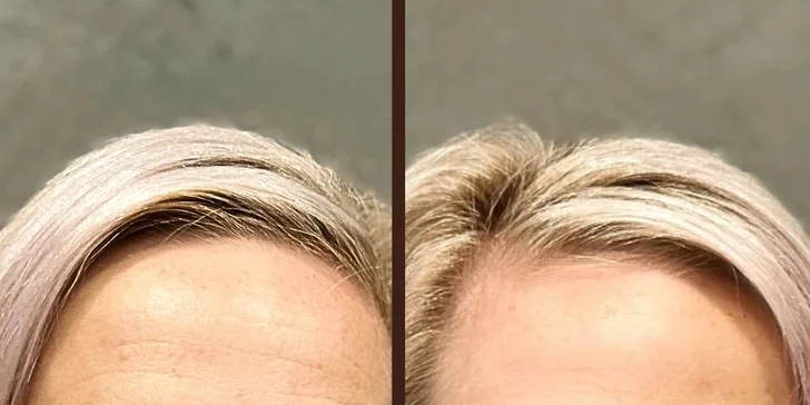 Rozmazlete se: dárkový poukaz na přístrojová ošetření do salónu Better You, 2500–⁠⁠⁠⁠⁠⁠15000 Kč