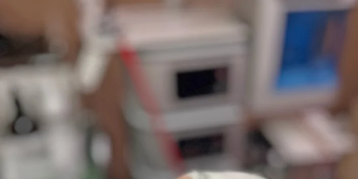 Ošetření problematické pleti nebo luxusní péče s galvanikou a kosmetickými masážemi