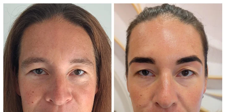 Přístrojové ošetření 7v1: diamantová mikrodermabraze, radiofrekvence i LED terapie