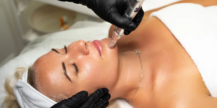 Mikrojehličkování pro omlazení pleti: 1 nebo 3 ošetření