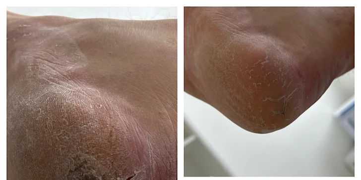 Opečujte své nohy: suchá či wellness pedikúra vč. lakování nehtů, 1–2 hodiny