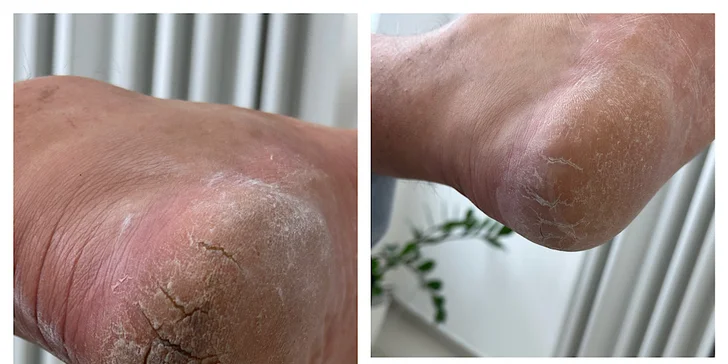 Opečujte své nohy: suchá či wellness pedikúra vč. lakování nehtů, 1–2 hodiny