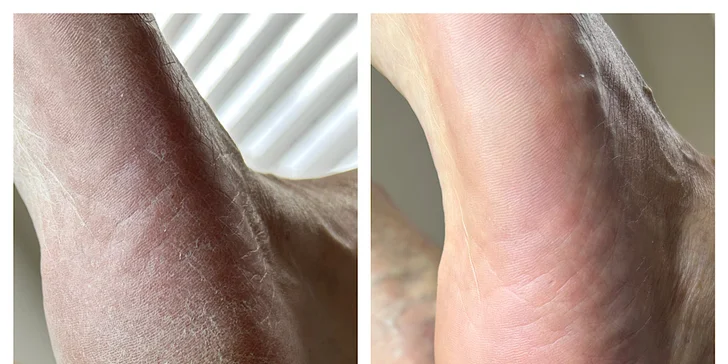 Opečujte své nohy: suchá či wellness pedikúra vč. lakování nehtů, 1–2 hodiny