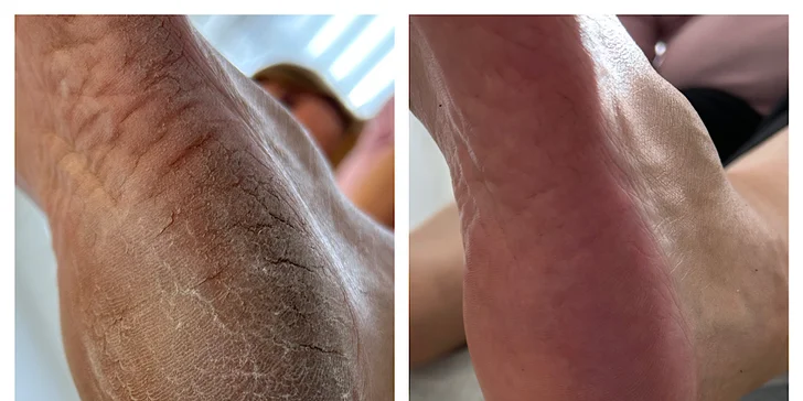 Opečujte své nohy: suchá či wellness pedikúra vč. lakování nehtů, 1–2 hodiny