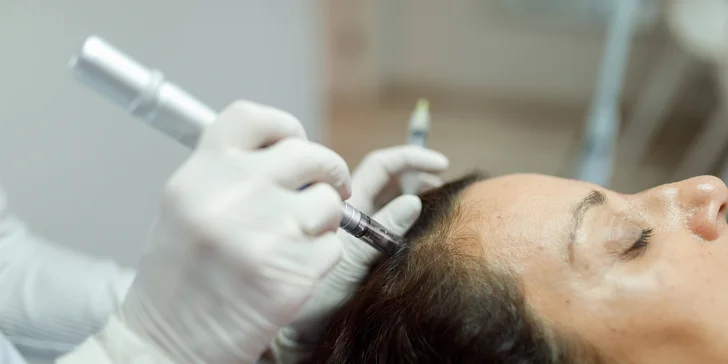 Mikrojehličkování obličeje, krku, dekoltu či pokožky hlavy