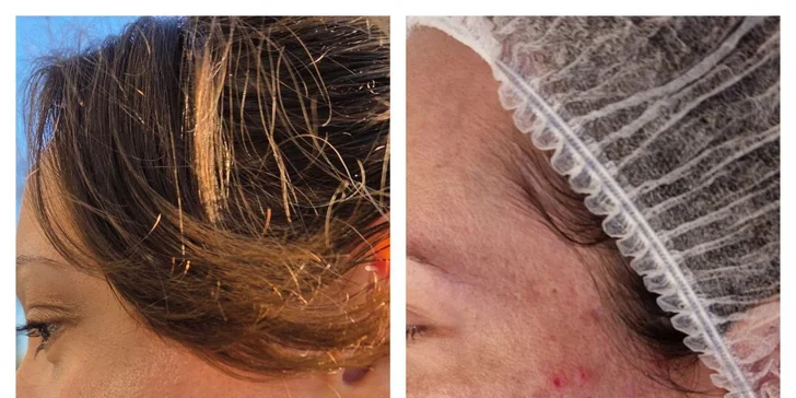 Kosmetika v Karlíně: základní péče, mezoterapie i hloubkové čištění s exozomy