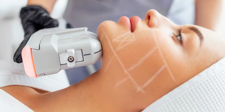 Omlazení a zpevnění pleti: Thermage či Hifu lifting obličeje, 30–⁠⁠⁠⁠⁠⁠60 minut